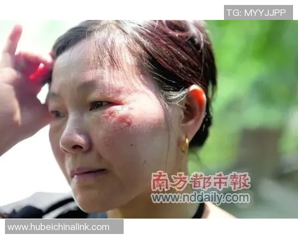 足球场上的咬人事件揭秘牙齿咬人的明星球员背后的故事 足球场上的咬人事件揭秘牙齿咬人的明星球员背后的故事